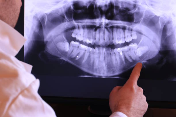 Best Walk-In Dentist Near Me  in Centreville, MI