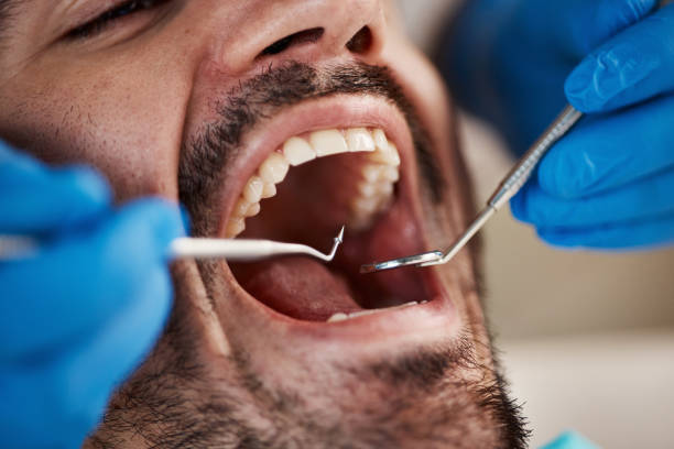 Best Emergency Pediatric Dentist  in Centreville, MI